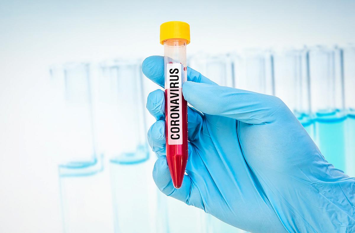 coronavirus_blood_test_-_photo_andrianocz_-_dreamstime.com_