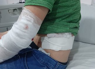 ახალციხეში ძაღლმა 9 ბავშვი დაკბინა