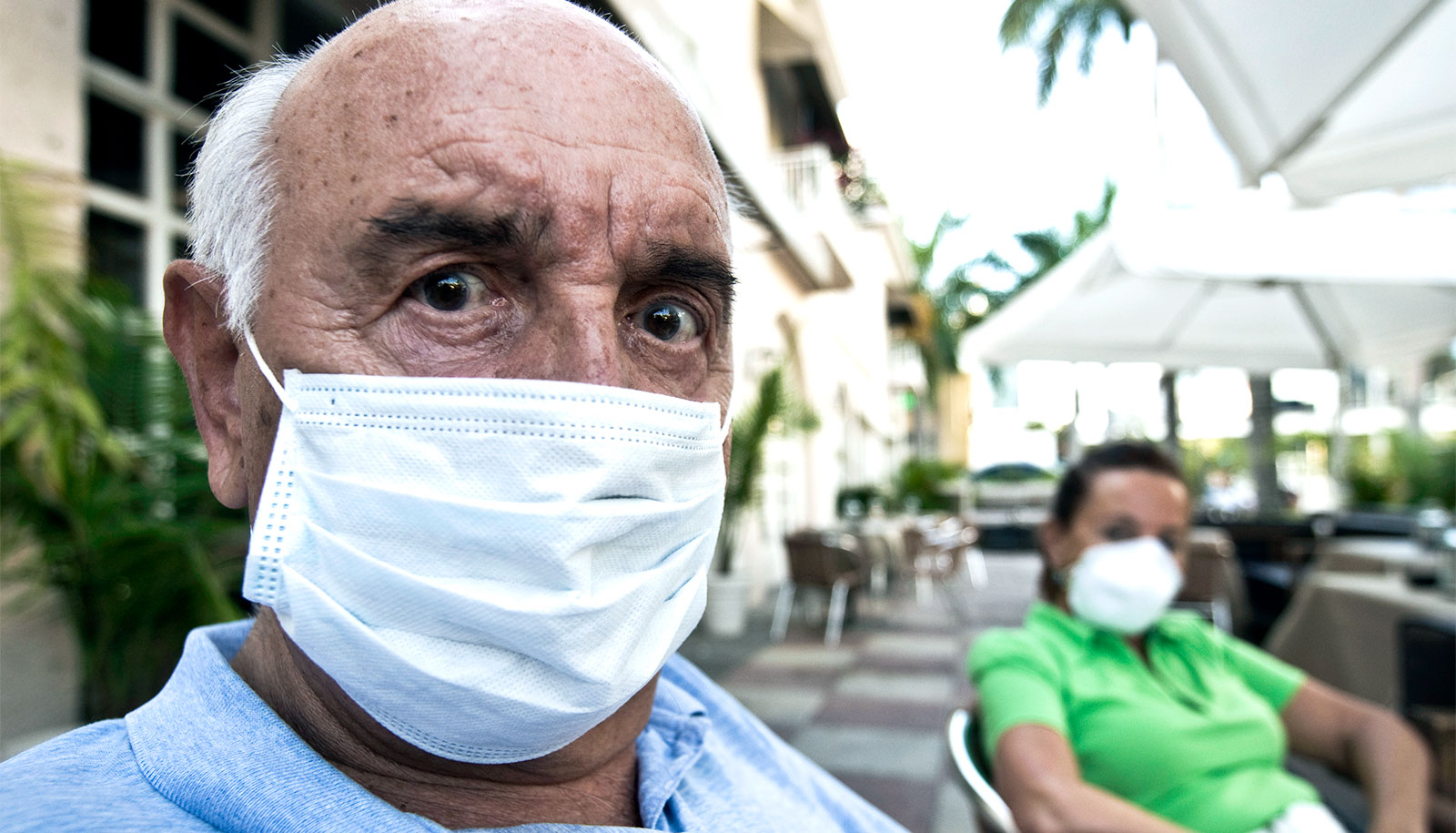 hair-loss-covid-19-severity_1600