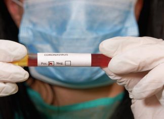 ცაგერში კორონავირუსის 5 შემთხვევა დადასტურდა